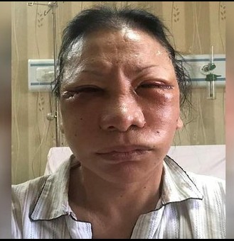 4 Babak drama Ratna Sarumpaet dari wajah lebam hingga ditangkap polisi