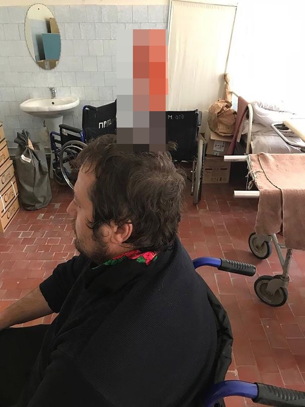 Pria ini tancapkan pisau di kepalanya, alasannya bikin geleng kepala