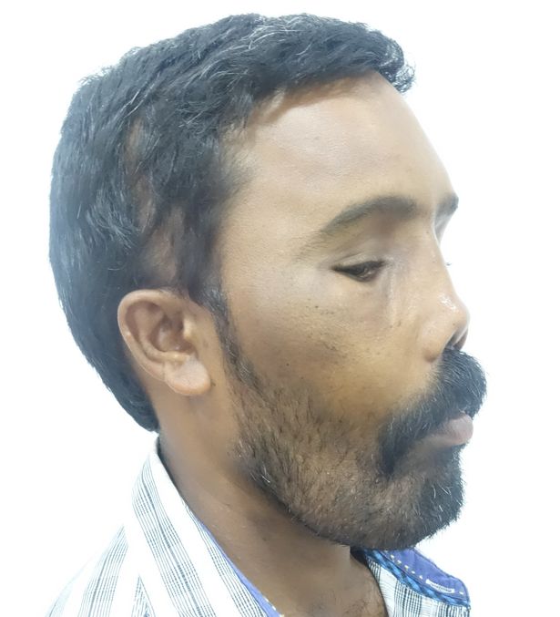 Lion Face © 2018 brilio.net Lion Face © 2018 brilio.net
