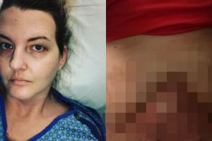 Alih-alih jadi cantik, wanita ini justru alami hal tragis saat operasi