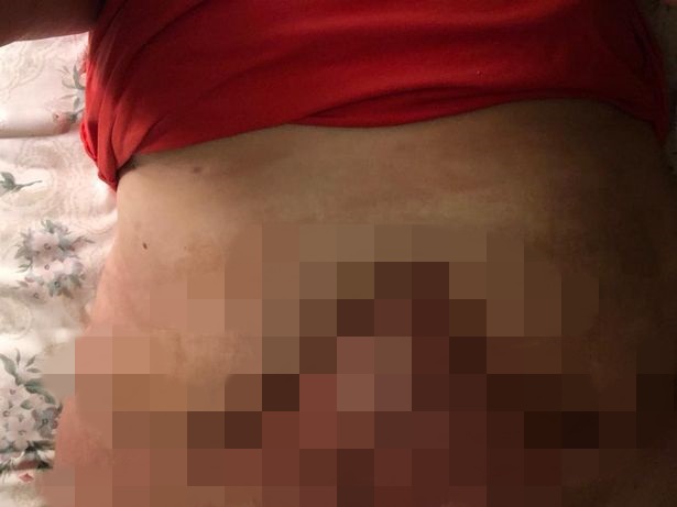 Alih-alih jadi cantik, wanita ini justru alami hal tragis saat operasi