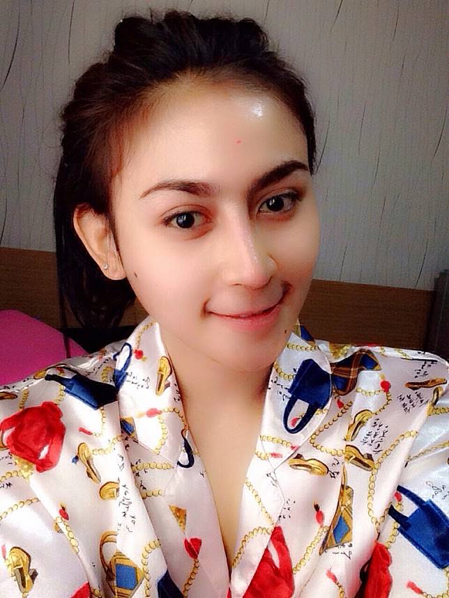 Tak hanya Rini Puspitawati, kecelakaan 4 model ini pernah jadi sorotan
