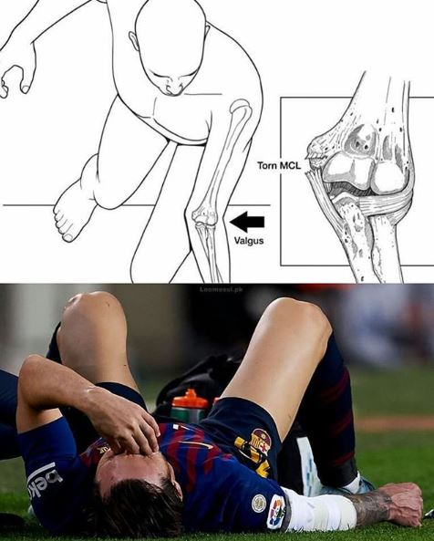 10 Meme meratapi cedera Lionel Messi, bikin pecinta bola makin nyesek