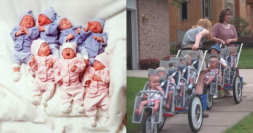 Kini berusia 21 tahun, ini 16 potret transformasi bayi kembar tujuh