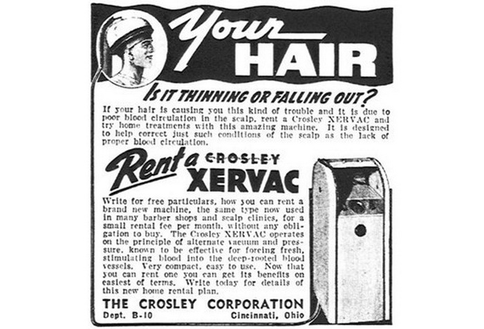 10 Cara atasi kebotakan, ada yang pakai sperma kerbau