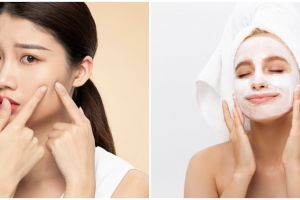 25 Cara menghilangkan bekas jerawat & flek hitam, ampuh dan aman