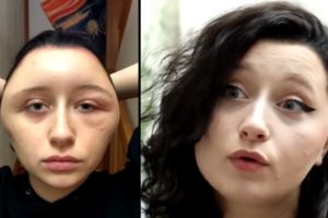 Pakai pewarna rambut, kepala wanita ini berubah mengerikan