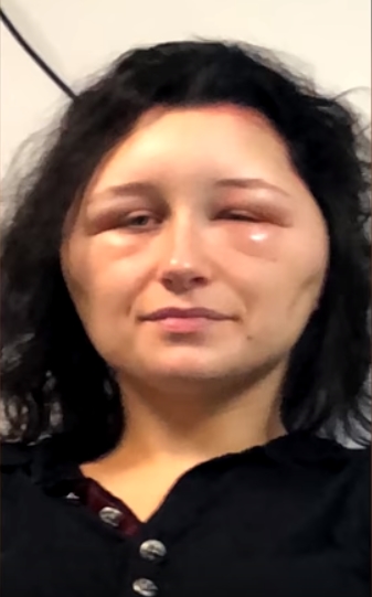 Pakai pewarna rambut, kepala wanita ini berubah mengerikan