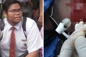 Pakai earphone saat HP dicas, remaja ini alami nasib tragis