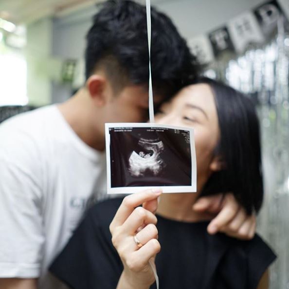 7 Tren kehamilan di kalangan seleb, foto maternity hingga doula