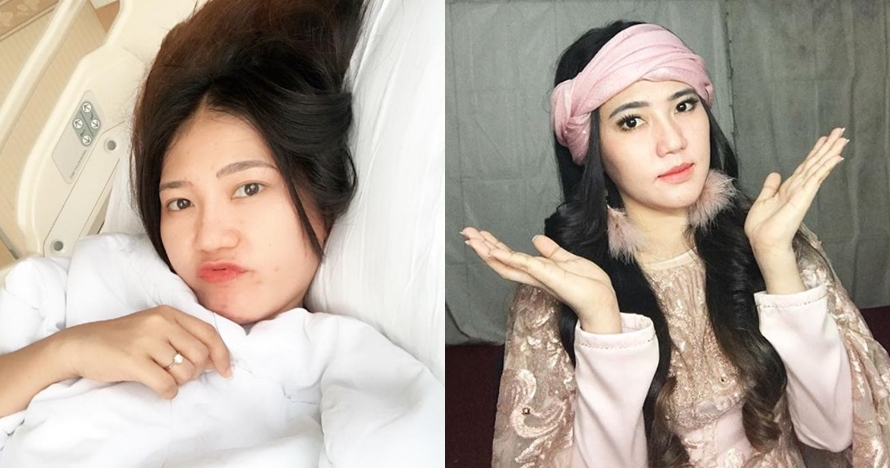 Beda penampilan 8 penyanyi dangdut pakai dan tanpa makeup