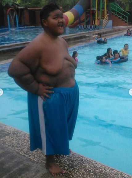 7 Perubahan Aria Permana bocah obesitas 192 kg, bikin pangling