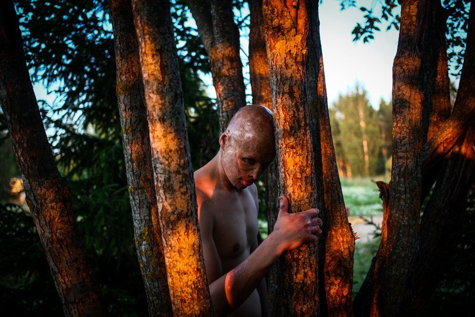 Kisah pria dulu dilempar ayahnya ke api usai rayakan tahun baru