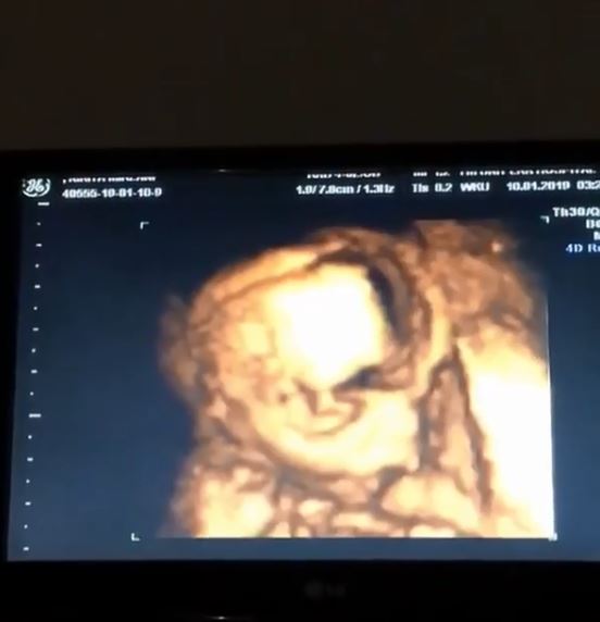 Curahan hati Nikita Mirzani berjuang hamil tanpa suami, bikin haru