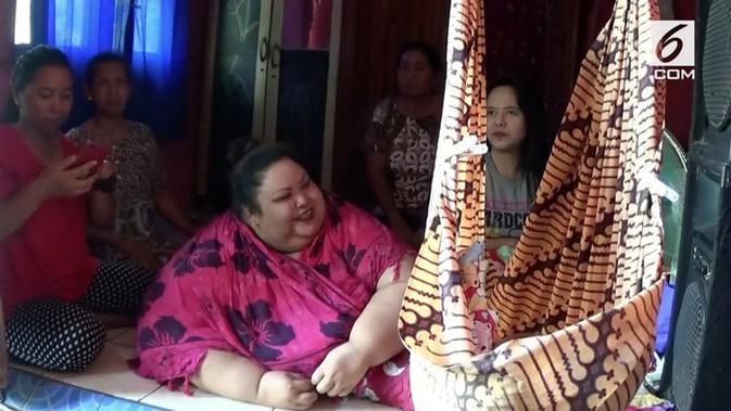 4 Fakta penyebab obesitas Titi Wati, wanita berbobot 350 kg