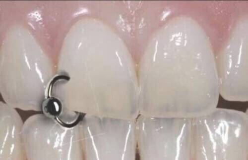 13 Potret janggal ini bikin mata nggak nyaman, geregetan banget