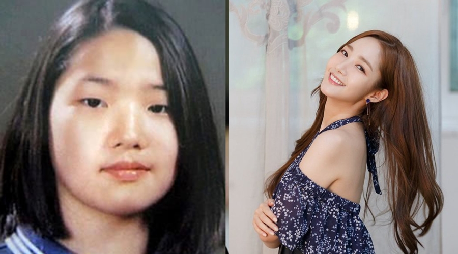 9 Seleb cantik Korea ini tak segan akui pernah operasi plastik