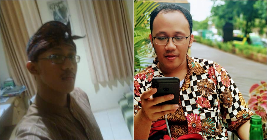 15 Foto Ten Year Challenge, bukti transformasi itu nyata