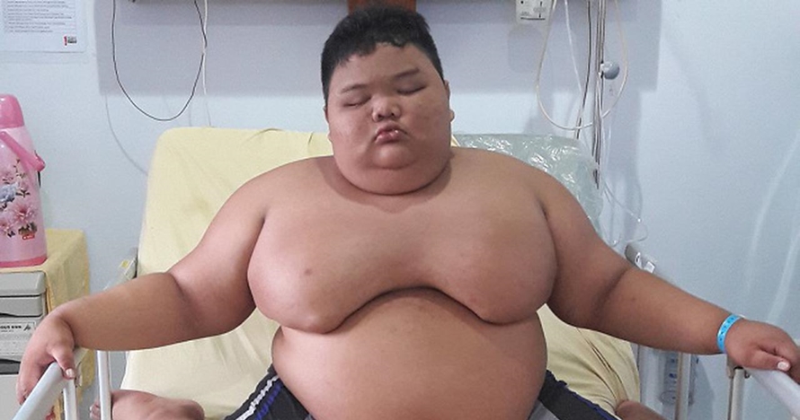 4 Kisah orang obesitas ini viral di Indonesia, terbaru Titi Wati