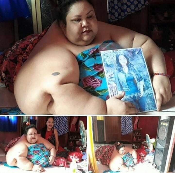 4 Kisah orang obesitas ini viral di Indonesia, terbaru Titi Wati