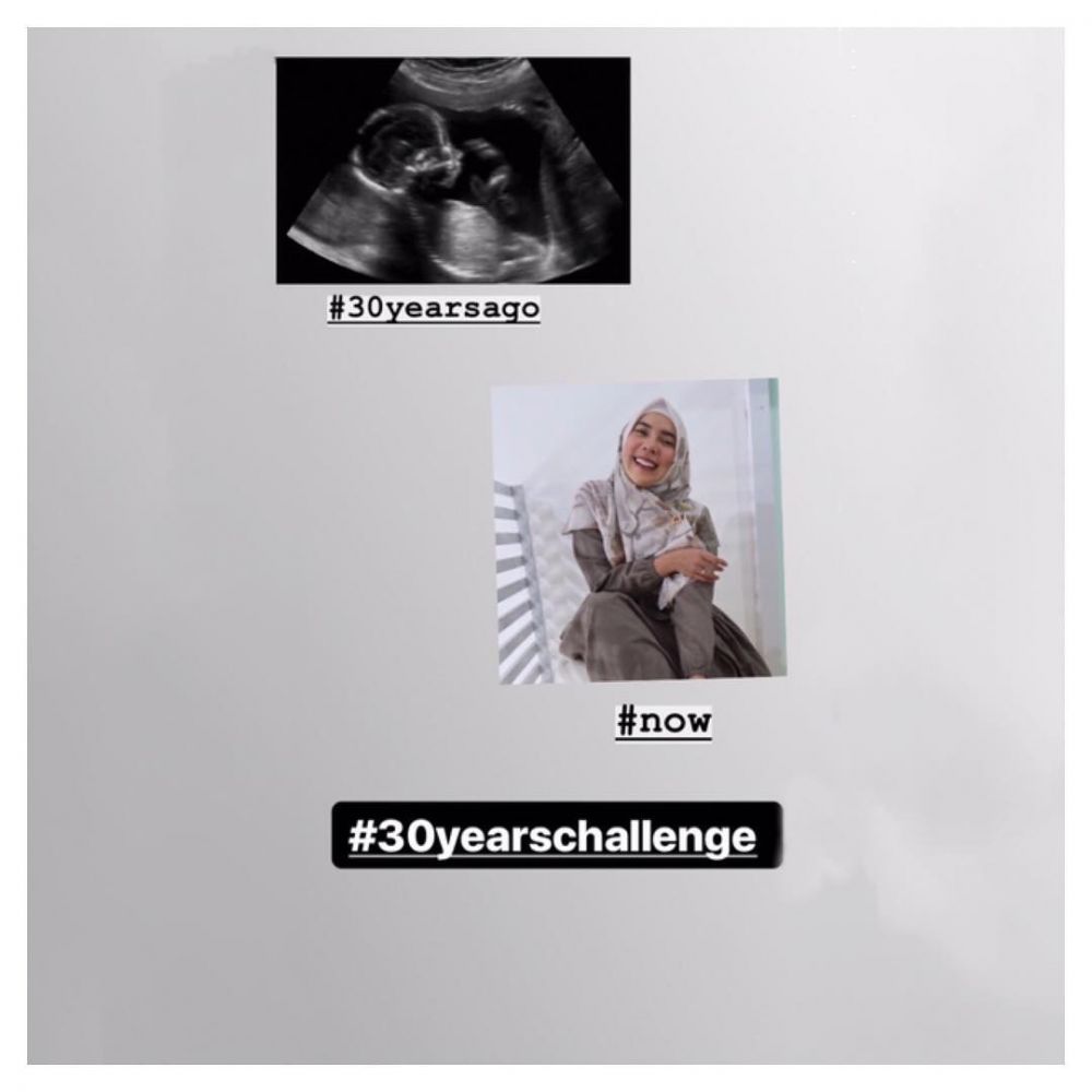 11 Seleb ikutan 10 Years Challenge, foto transformasinya kocak