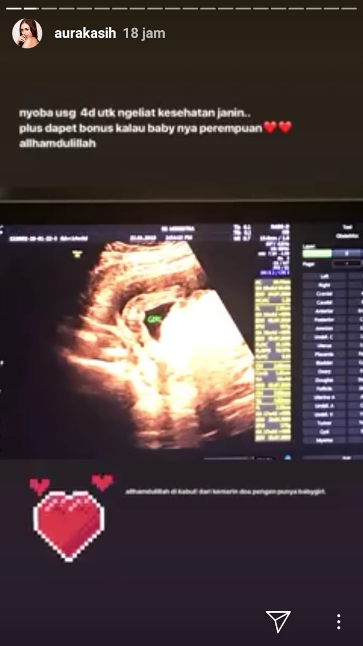 Ungkapan bahagia Aura Kasih saat bocorkan jenis kelamin bayinya