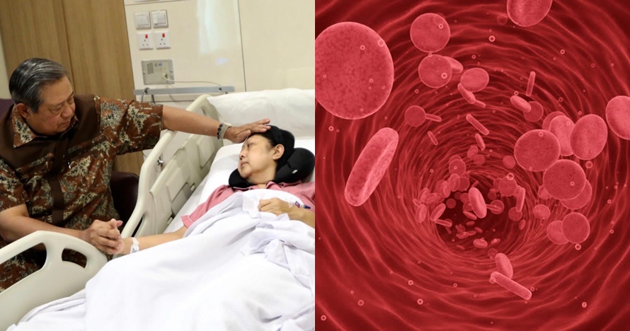 Fakta kanker darah yang perlu kamu tahu, penyakit Ani Yudhoyono