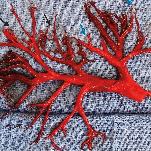 12 Manfaat durian bagi tubuh, bikin tambah semangat makannya