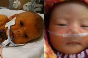 Kisah pilu orangtua minta edit foto anaknya tanpa selang medis