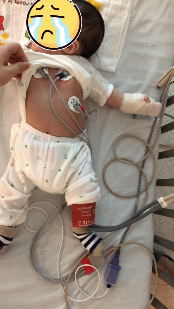 Kisah pilu bayi 2 bulan jatuh dari tangga, tempurung kepalanya retak
