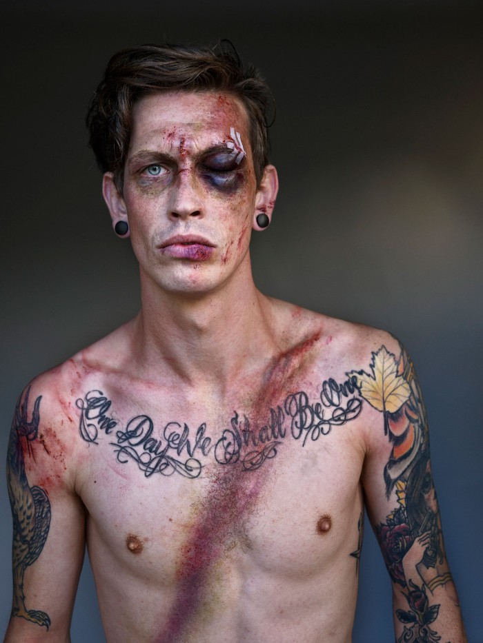 10 Pemotretan tentang orang yang bertahan dari kecelakaan, ngeri