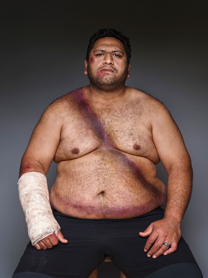 10 Pemotretan tentang orang yang bertahan dari kecelakaan, ngeri