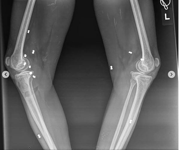 7 Potret miris kondisi orang utan di Aceh, ditembaki 74 peluru