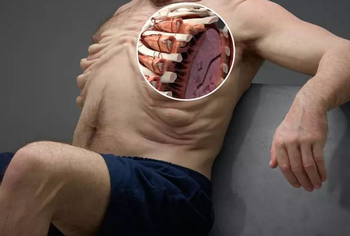 10 Anatomi tubuh orang yang akan bertahan dari tabrakan, aneh