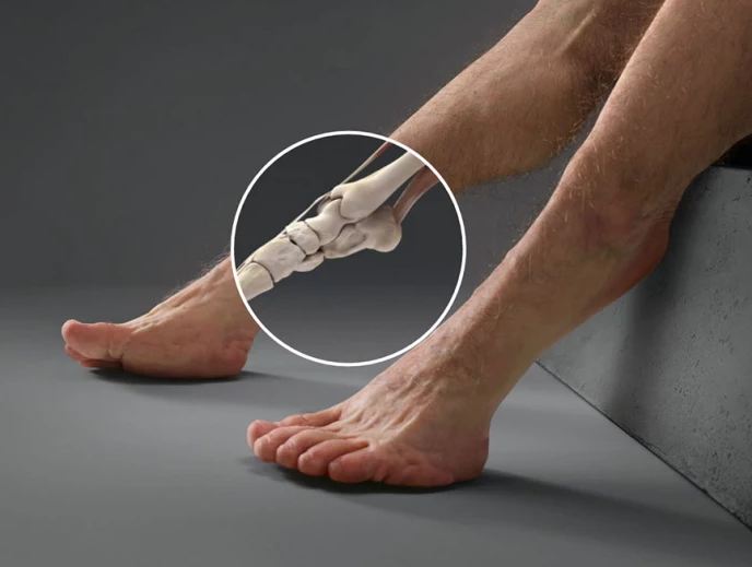 10 Anatomi tubuh orang yang akan bertahan dari tabrakan, aneh