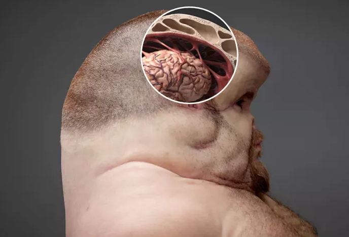 10 Anatomi tubuh orang yang akan bertahan dari tabrakan, aneh