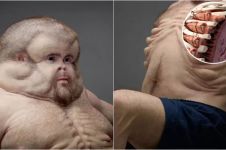 10 Anatomi tubuh orang yang akan bertahan dari tabrakan, aneh