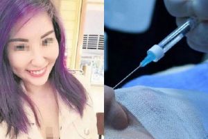 Gara-gara perawatan Botox, nasib wanita cantik ini berujung tragis