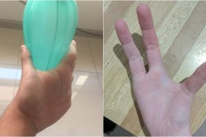 15 Orang ini alami kelainan genetik tapi malah terlihat unik