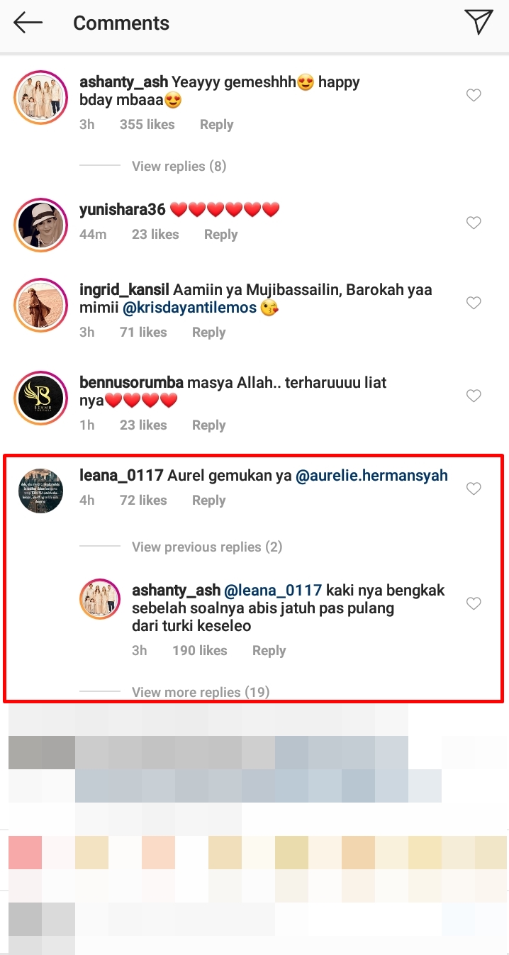Kaki Aurel Hermansyah jadi sorotan, begini pembelaan Ashanty