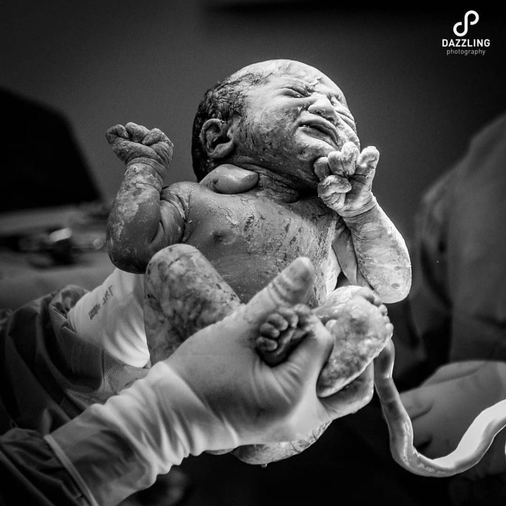 Chikita Meidy melahirkan, ini 6 potret perjuangan & nama bayinya