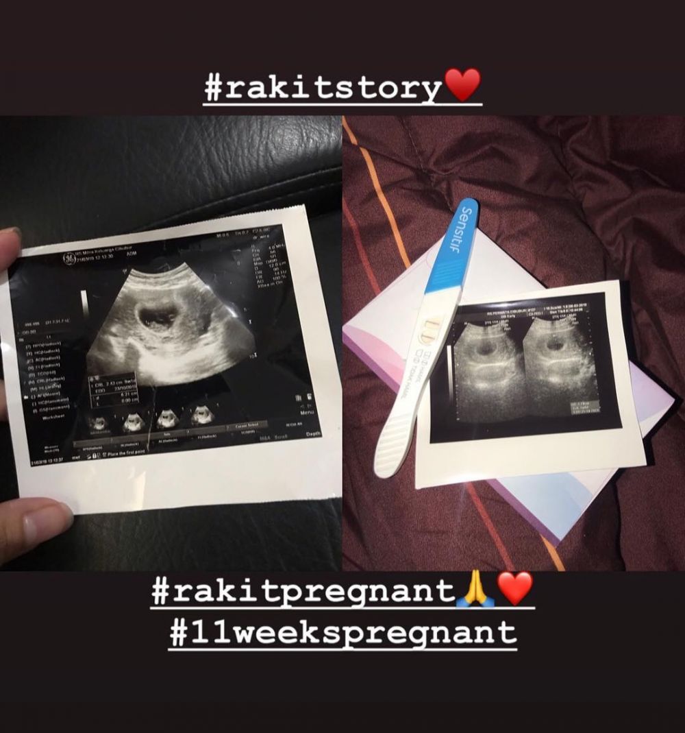 Raya Kitty umumkan kehamilan, jadi kado terindah seumur hidup