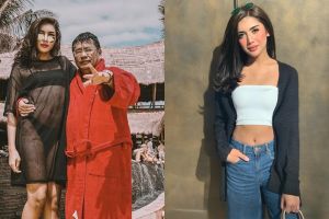 5 Pengakuan Millendaru kepada Hotman Paris, tak operasi plastik