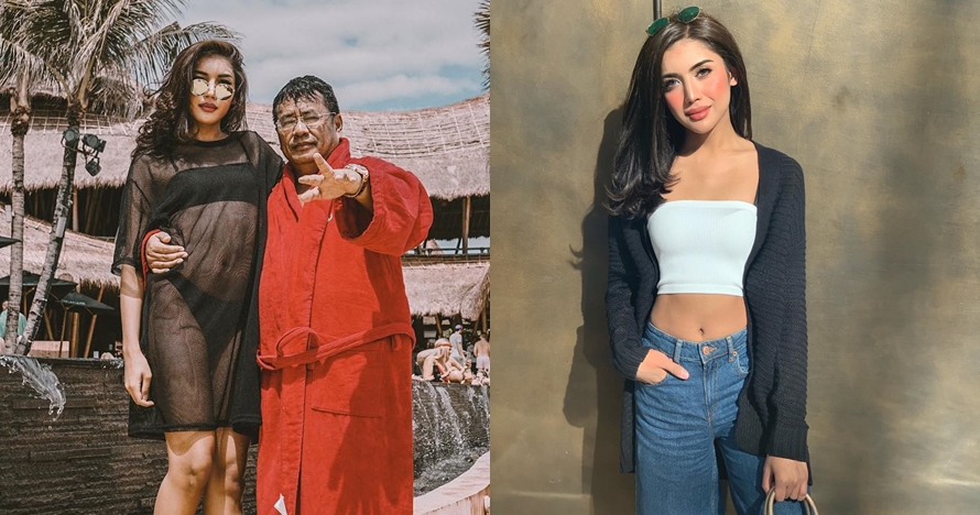 5 Pengakuan Millendaru kepada Hotman Paris, tak operasi plastik