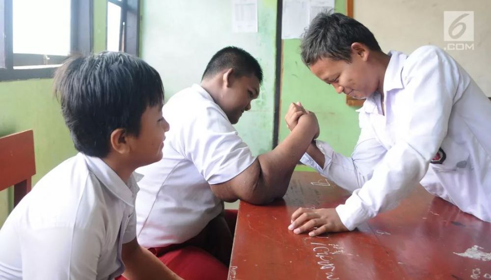 8 Potret terbaru Arya Permana yang dulu beratnya nyaris 200 kg