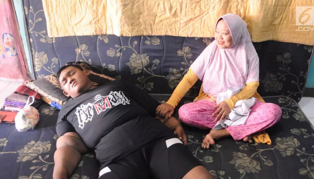 8 Potret terbaru Arya Permana yang dulu beratnya nyaris 200 kg