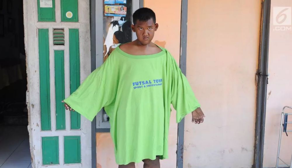 8 Potret terbaru Arya Permana yang dulu beratnya nyaris 200 kg