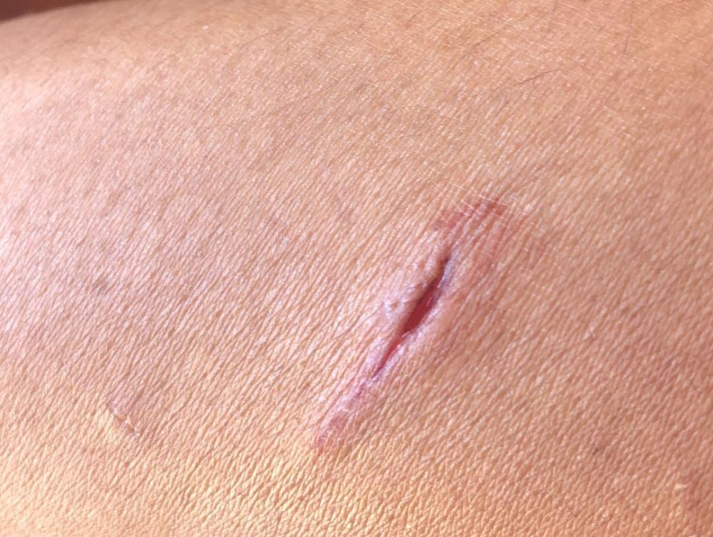 10 Potret liburan Indah Kalalo di Afrika Selatan, jelajah alam liar