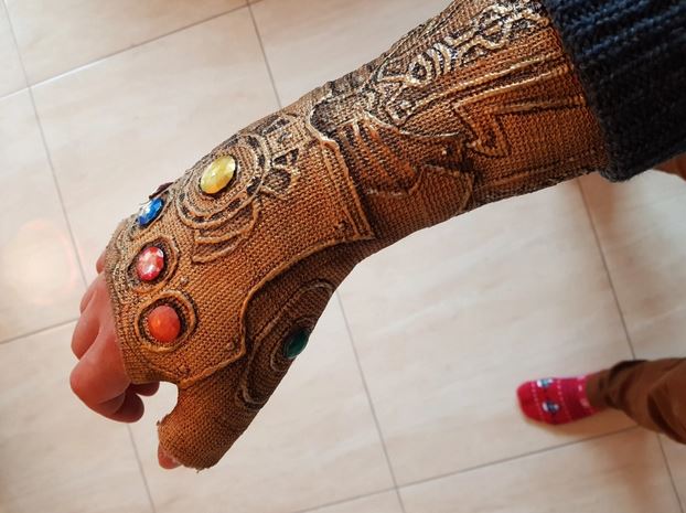 Pria patah tulang bikin perban bak tangan Thanos, ini 10 fotonya