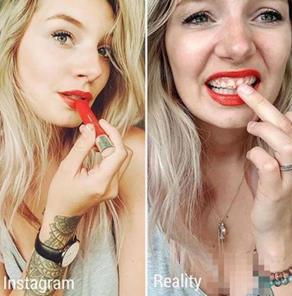 7 Foto perbedaan Instagram vs realita ala cewek ini benar adanya